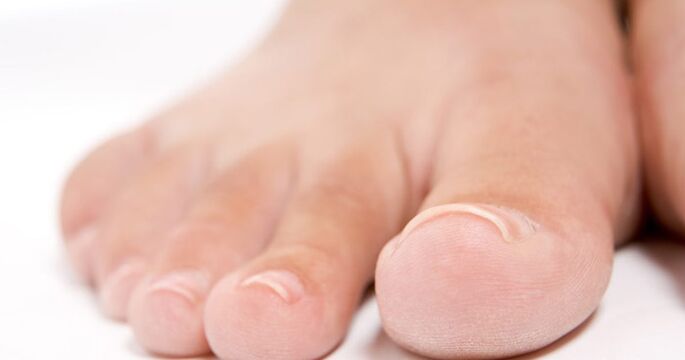 Toenails may be affected by fungal infections