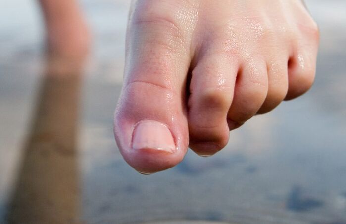 Wet feet encourage the spread of fungus